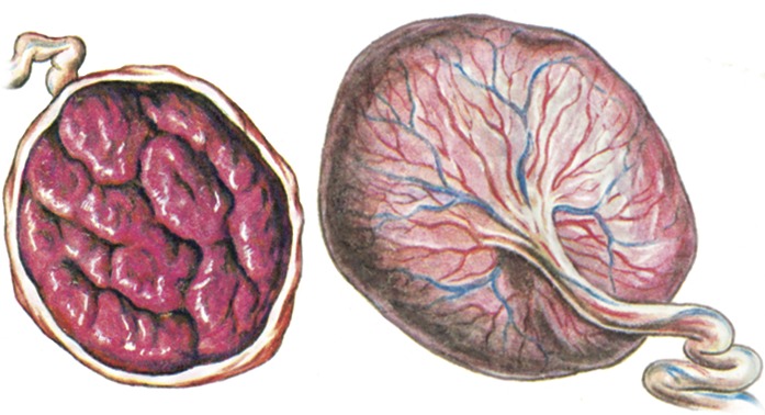 Детское место. Материнская поверхность плаценты. Двудольчатая плацента. Анатомия человека плод плацента.